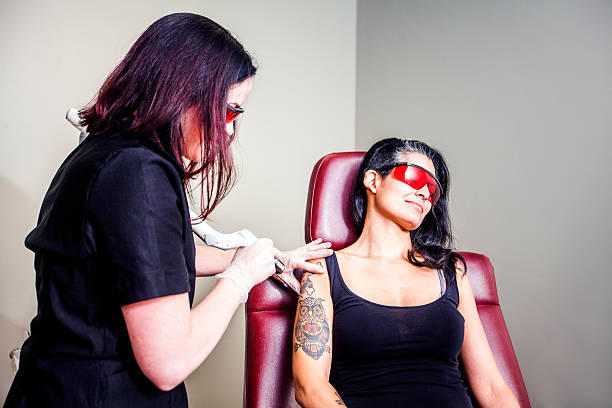 Laser Tattoo Removal